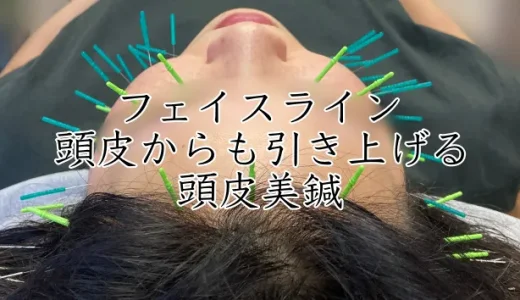 頭皮美鍼でリフトアップ