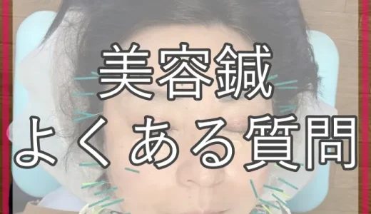 美容鍼のよくある質問