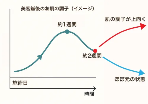 2週間目でまた美容鍼を受ける