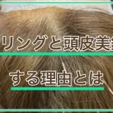 ピーリングと頭皮美鍼をする理由