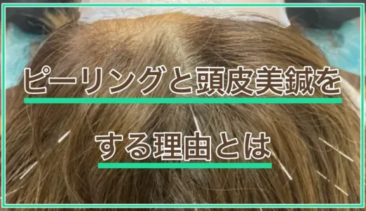 ピーリングと頭皮美鍼をする理由とは