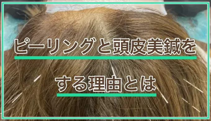 ピーリングと頭皮美鍼をする理由