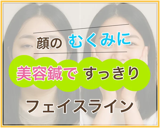 美容鍼でフェイスラインすっきり