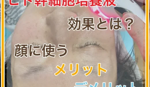 ヒト幹細胞培養液の効果とは？顔に使うメリットとデメリット！