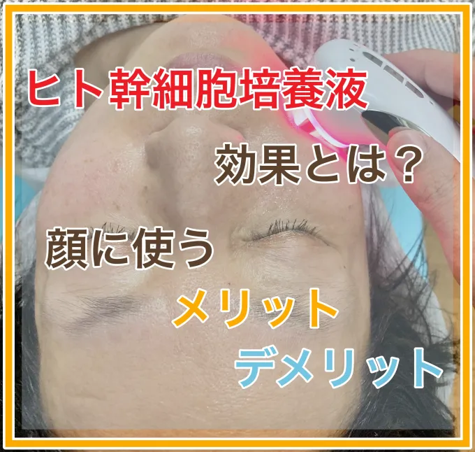 ヒト幹細胞培養液を使うメリットデメリット