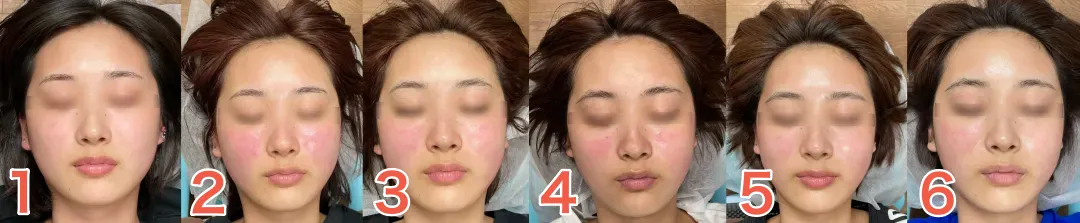 10代K様1回目から6回目