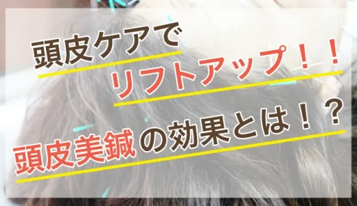 頭皮ケアで顔のリフトアップ！知られざる頭皮美鍼の効果