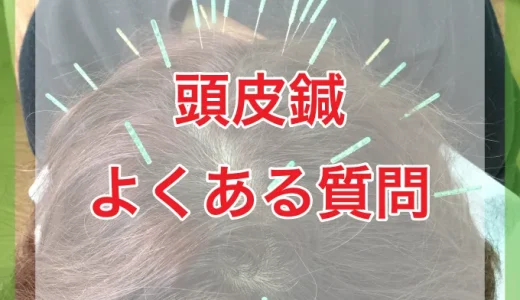 頭皮鍼のよくある質問