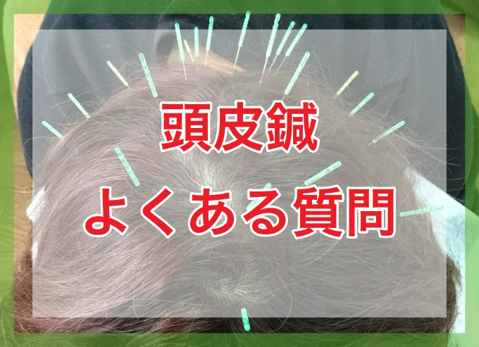 頭皮鍼のよくある質問