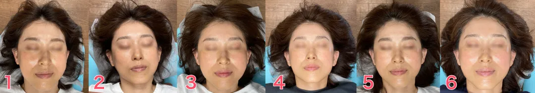 40代M様1回目から6回目