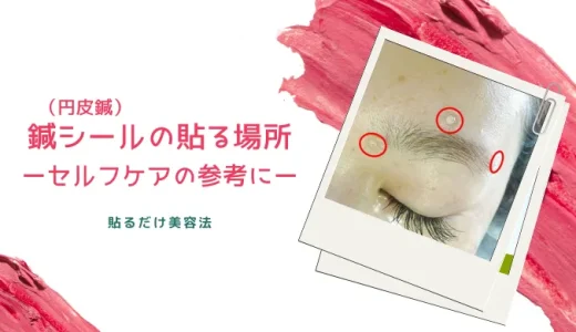 円皮鍼（鍼シール）の貼り方（貼る場所）のご紹介。ほうれい線などに貼っておうちでセルフ美容鍼