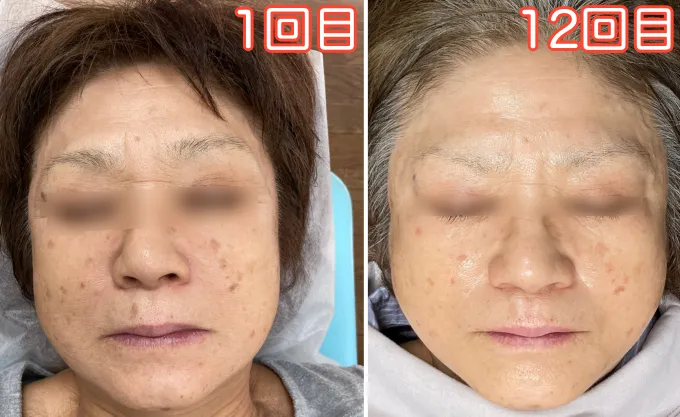 1回目と12回目の様子