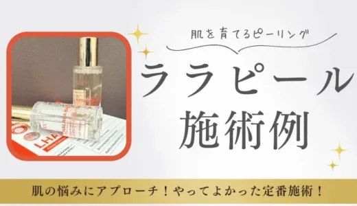ララピールの施術例