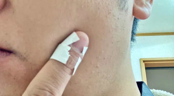 顔全体を軽い力でタッピング