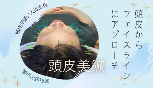 頭皮美鍼でリフトアップ