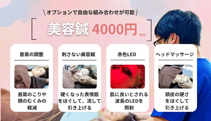 美容鍼は4000円〜