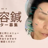 美容鍼のモニター募集