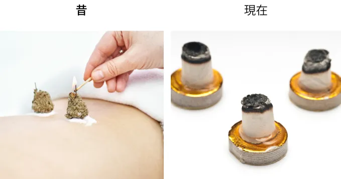 昔のお灸のイメージと今のお灸