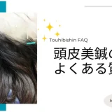 頭皮美鍼のよくある質問