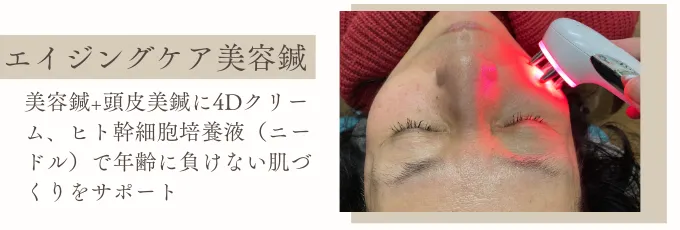 美容鍼+頭皮美鍼にヒト幹細胞培養液等を加えたエイジングケア美容鍼