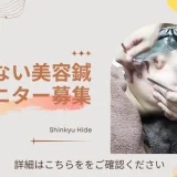 刺さない美容鍼モニター募集