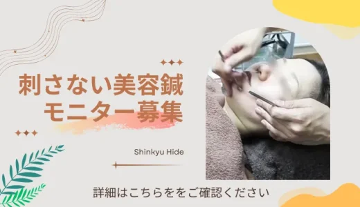 刺さない美容鍼モニター募集