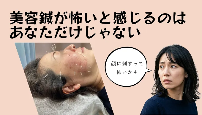 美容鍼が怖いかもと思っている女性