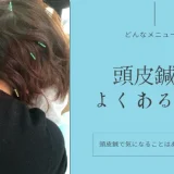 頭皮鍼のよくある質問