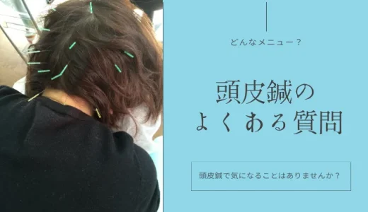 頭皮鍼のよくある質問