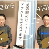 美容鍼4回の比較