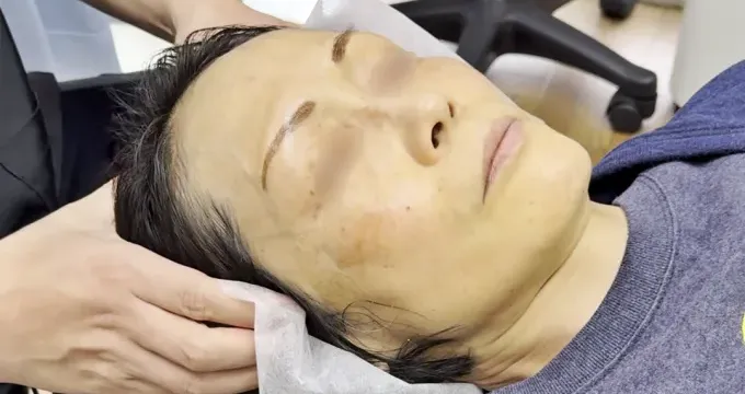 頭皮美鍼の流れ1、頭皮ほぐし