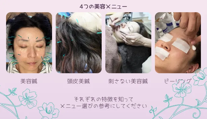 4つの美容メニュー