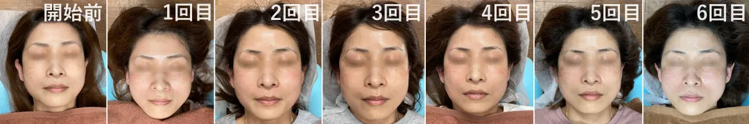 U様開始前から6回目まで