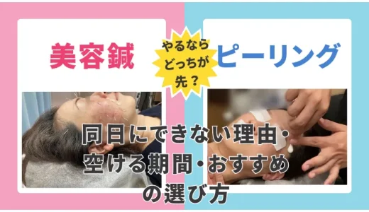 美容鍼とピーリングはどっちが先？同日にできない理由・空ける期間・おすすめの選び方