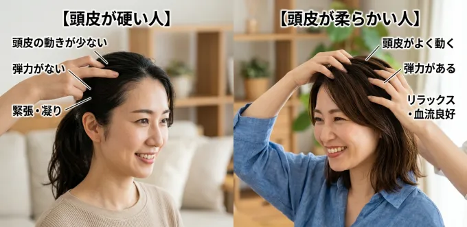 頭皮が硬い人、柔らかい人