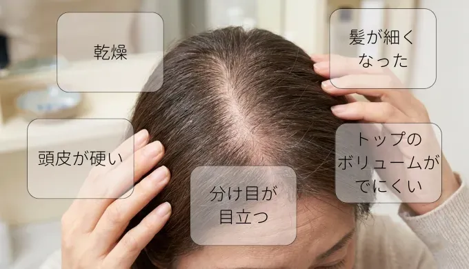 年齢とともに頭皮は表情を変える