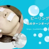 ピーリングとは?