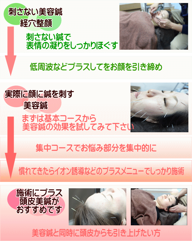 美容鍼なら大阪府豊中市の鍼灸癒し処 英へお越しください 頭皮美鍼 刺さない美容鍼