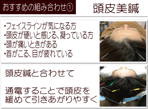 頭皮の鍼