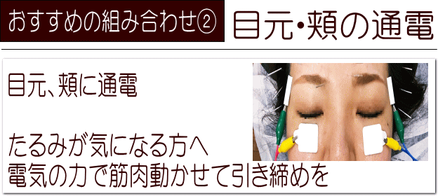 エレクトロハンド